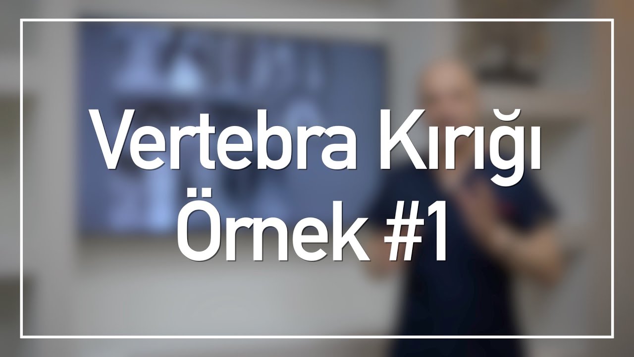 T12 Çökme Kırığı | Vertebra Kırığı Vaka Örnekleri #1