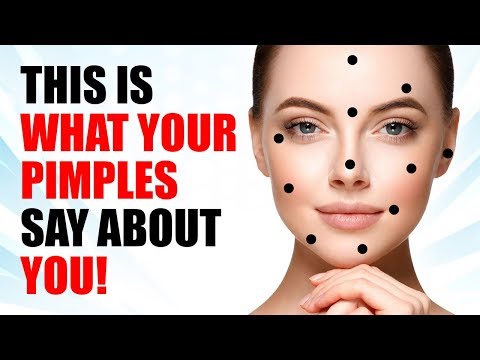 What Your Acne Is Telling You About Your Health - Face Mapping