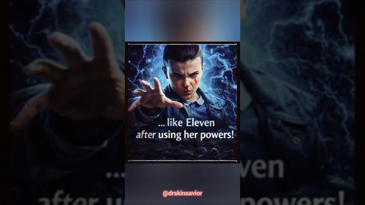 Stranger Things On Your Skin/Episode 3/ Why Use Too Much Power! 