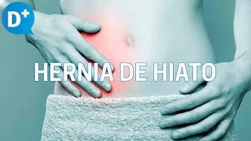 ¿Dónde se localiza el dolor de la hernia de hiato?