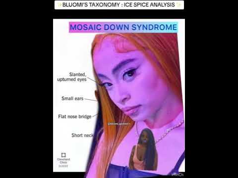 ICE SPICE & HER UNIQUE FEATURES : MOSAIC DOWN SYNDROME ? - YouTube