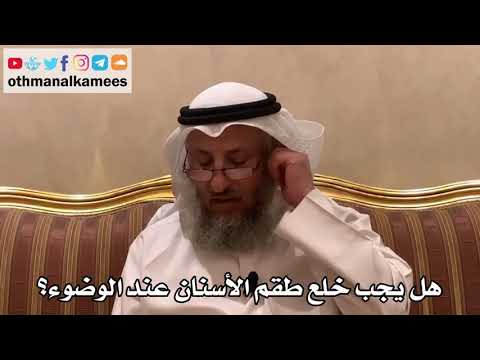 399 - هل يجب خلع طقم الأسنان عند الوضوء؟ - عثمان الخميس