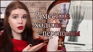 ХОДИЛА С ПЕРЕЛОМОМ 2 МЕСЯЦА 🤦‍♀️ | ДИПЛОМ, РАБОТА, ПОХУДЕНИЕ