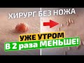 Мама СПАСЛА этим "Хирургом без ножа"! Метод удаления папиллом в домашних условиях