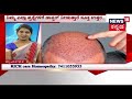 Hello Doctor | Hair Fall Treatment With Rich Care Homeopathy Dr. Preethi | June 12, 2018