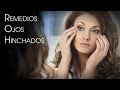 Remedios Naturales para Ojos Hinchados o Puffy Eyes