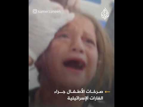 أغلب الشهداء تحت القصف الإسرائيلي أطفال