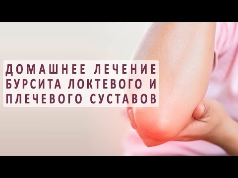 Домашнее лечение бурсита локтевого и плечевого суставов