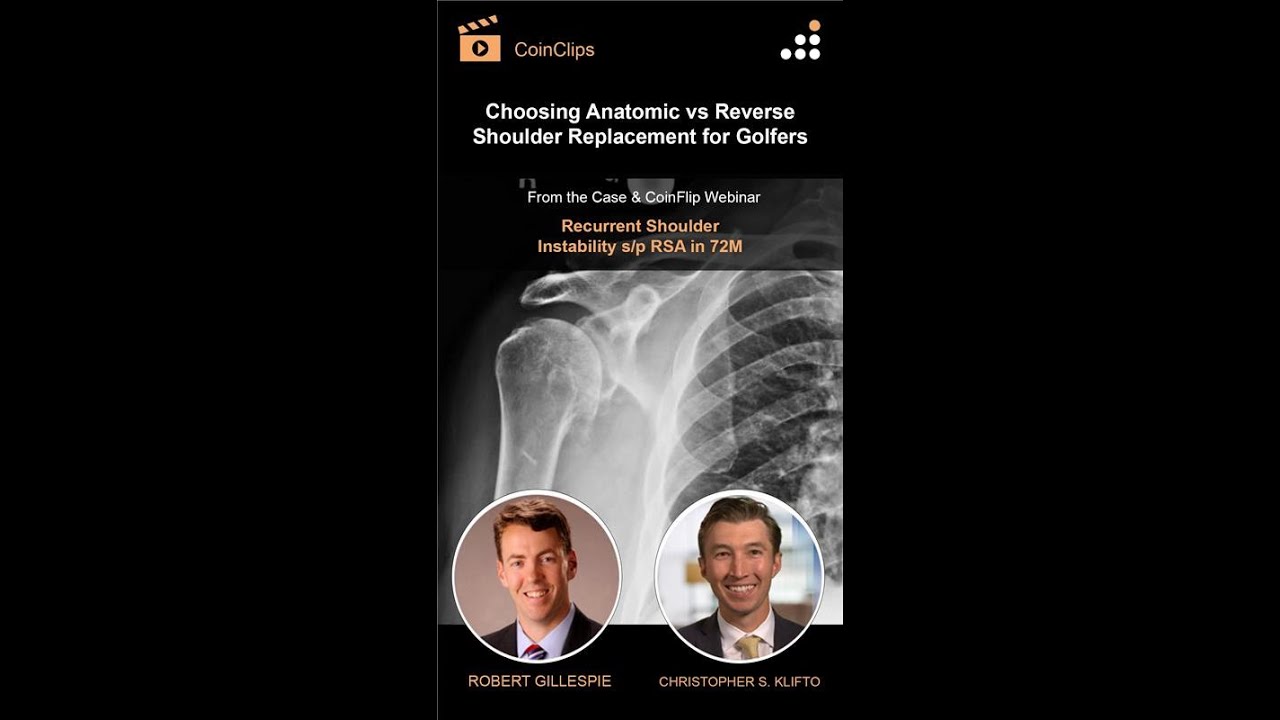 Choosing Anatomic vs Reverse Shoulder Replacement for Golfers - YouTube