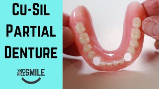 What is a Cusil Partial Denture