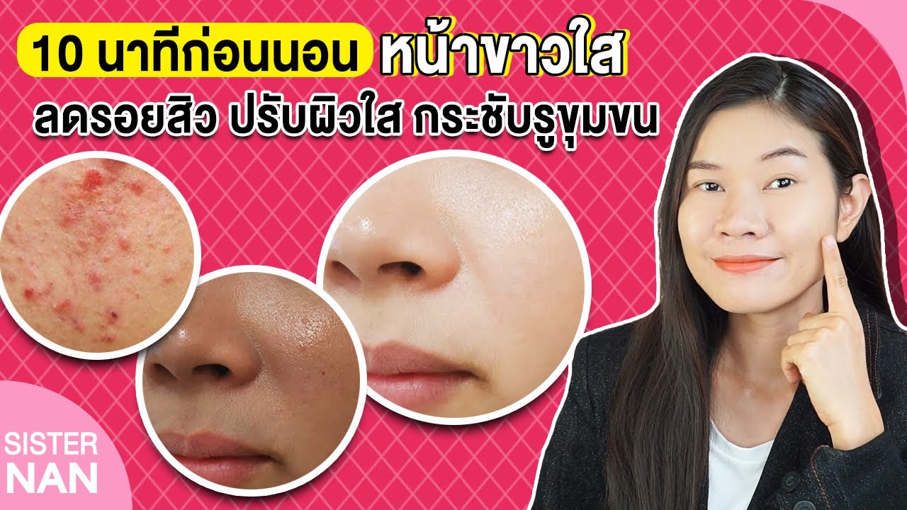 10นาที หน้าใสขึ้น ผิวขาวกระจ่างใส ลดหน้ามัน รอยสิว รอยดำ รอยแผลเป็นจากสิว  จุดด่างดำ| แนน Sister Nan - Youtube