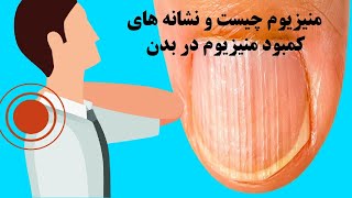 منیزیوم چیست و نشانه های کمبود منیزیوم در بدن !