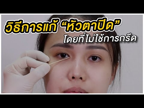 วิธีการทำตาสองชั้นที่มี "หัวตาปิด" โดยที่ไม่ใช้การกรีด ? ความรู้ทางวิชาการจากคุณหมอชลธิศ