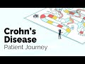 Crohns disease patient journey  gastrointestinal society