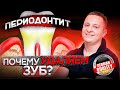 Когда нужно удалять зуб при периодонтите? Немецкий имплантологический центр