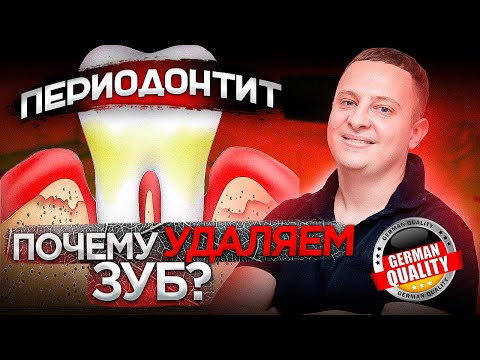 Вопрос: Как определить абсцесс зуба?