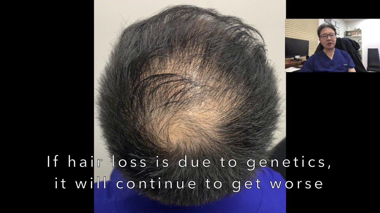 Hair Loss YouTube