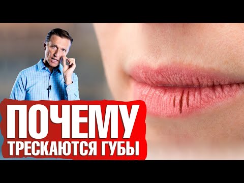 Почему трескаются губы? Сухие губы: что делать👄