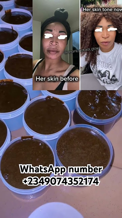 Her skin took a new turn when she start using our products from pale skin to yellow tone complexion