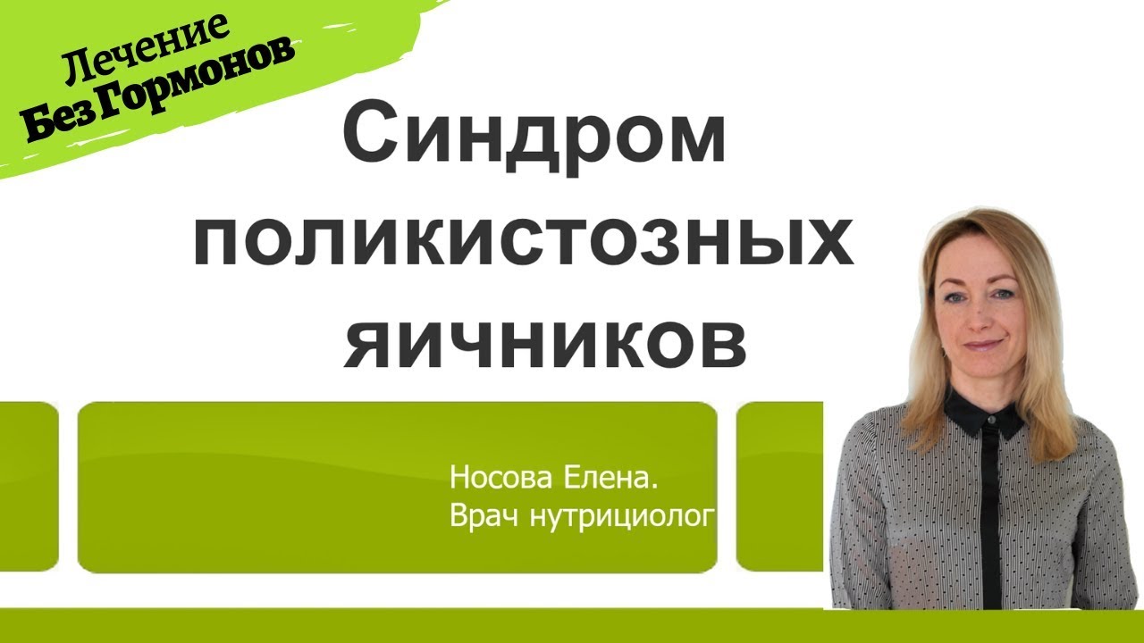 Синдром Поликистозных Яичников. Лечение без гормонов.
