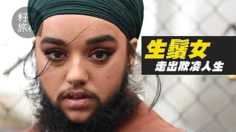 【胡须模特儿】英国女患怪病满脸生须 ：“世界没有容纳我的位置” #果籽英国 - 天天要闻