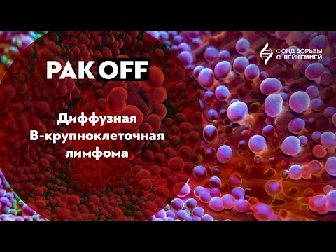 РакOFF: Диффузная В-крупноклеточная лимфома (ДВКЛ)