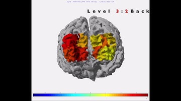Optical Brain Imaging (fNIRS) using our Device during Working Memory Task