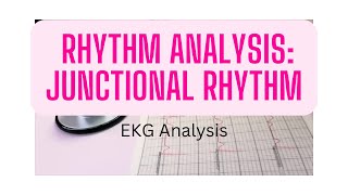 EKG Rhythm Analysis: Junctional rhythm
