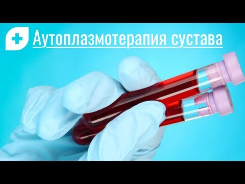 Аутоплазмотерапия суставов без боли и операции.