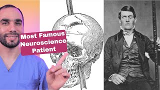 This can damage your personality | Phineas Gage story