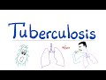 Tuberculosis tb formerly phthisis pulmonalis  respiratory pathology