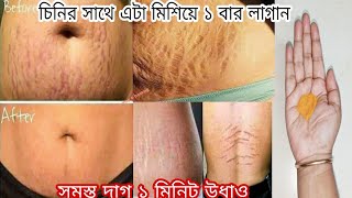 চিনির সাথে এটা মিশিয়ে লাগান/গর্ভকালীন ফাটা দাগ সহ শরীরের সমস্ত দাগ এক মিনিটে উধাও... screenshot 5