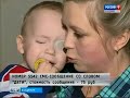 Даня Рыжков, 2 года, детский церебральный паралич, спастический тетрапарез, деформация стоп