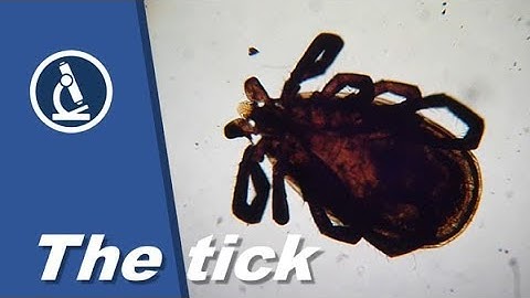 🔬 008 - How do you make a whole mount microscope slide?