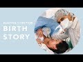 My Elective C-Section Birth Story | Susan Yara