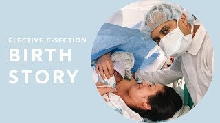 My Elective CSection Birth Story | Susan Yara