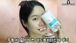 Pantothenic Acid Acne Supplement, Honest Review of Skin Supplements (feat. skinB5 Acne Vitamin💊)