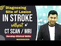 HOW TO DIAGNOSE SITE OF LESION IN STROKE WITHOUT CT-SCAN / MRI