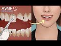 🦷Relaxing Dental Clinic care ASMR 🌿animation cavity treatment / broken teeth care /scaling