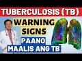 Tuberculosis (TB) Warnings Signs. Paano Maalis ang TB. - By Doc Willie Ong