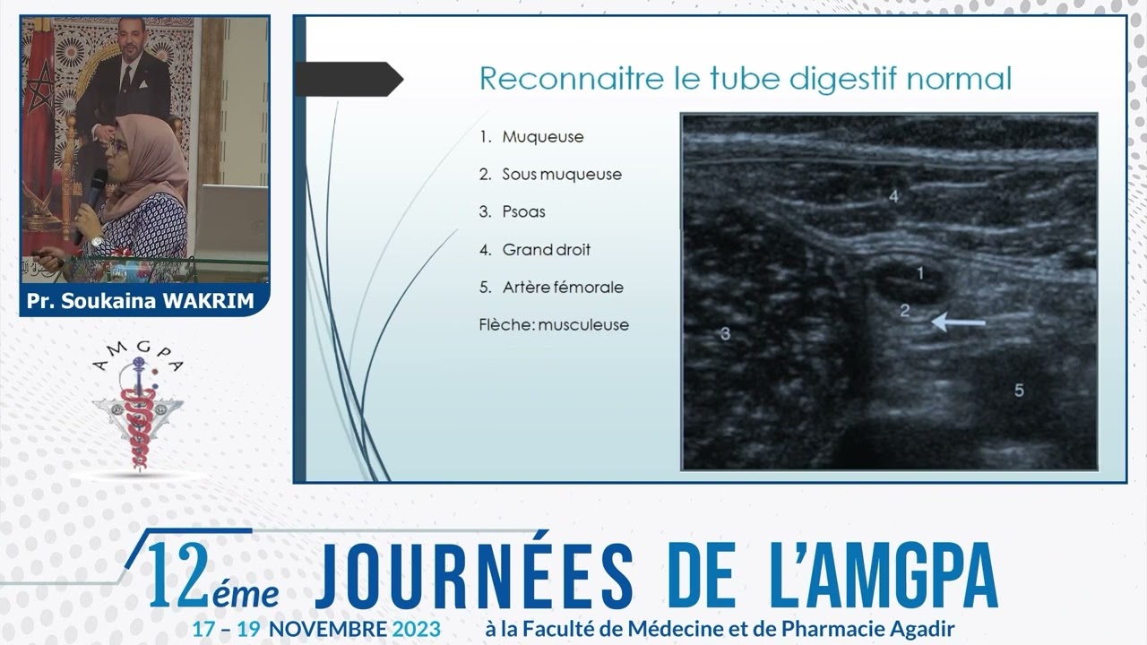 ECHOGRAPHIE DIGESTIVE/Pr  Soukaina WAKRIM