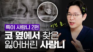 사랑니야 어디갔니?😭ㅣ잃어버렸던 사랑니🦷를 찾은 뜻밖의 장소는?!