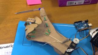 Servo driven robot hand