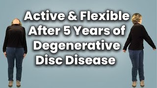 Active & Flexible After Five Years of Degenerative Disc Disease