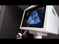 ecografia 3 meses  || ecogafria 12 semanas || ultrasound 12 week ultrasound 3 meses