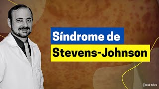 Síndrome de Stevens-Johnson | José Góes