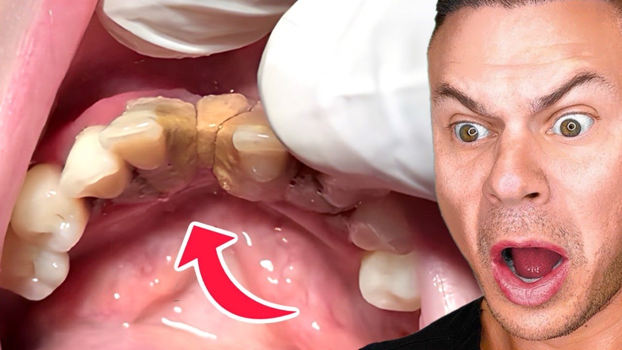 The Strangest Dental Videos I’ve Ever Reacted To
