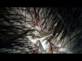 【フケpart13】パリッとこんがり焼き上げたようなフケたち .[Dandruff part13] dandruff us, such as baked golden brown and crisp.