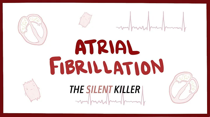 Why they call it the Silent Killer, What is Atrial Fibrillation
