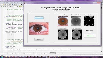 Iris Segmentation and Recognition System for Human Identification Matlab code